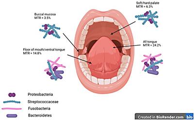 Influence of site and smoking on malignant transformation in the oral cavity: Is the microbiome the missing link?